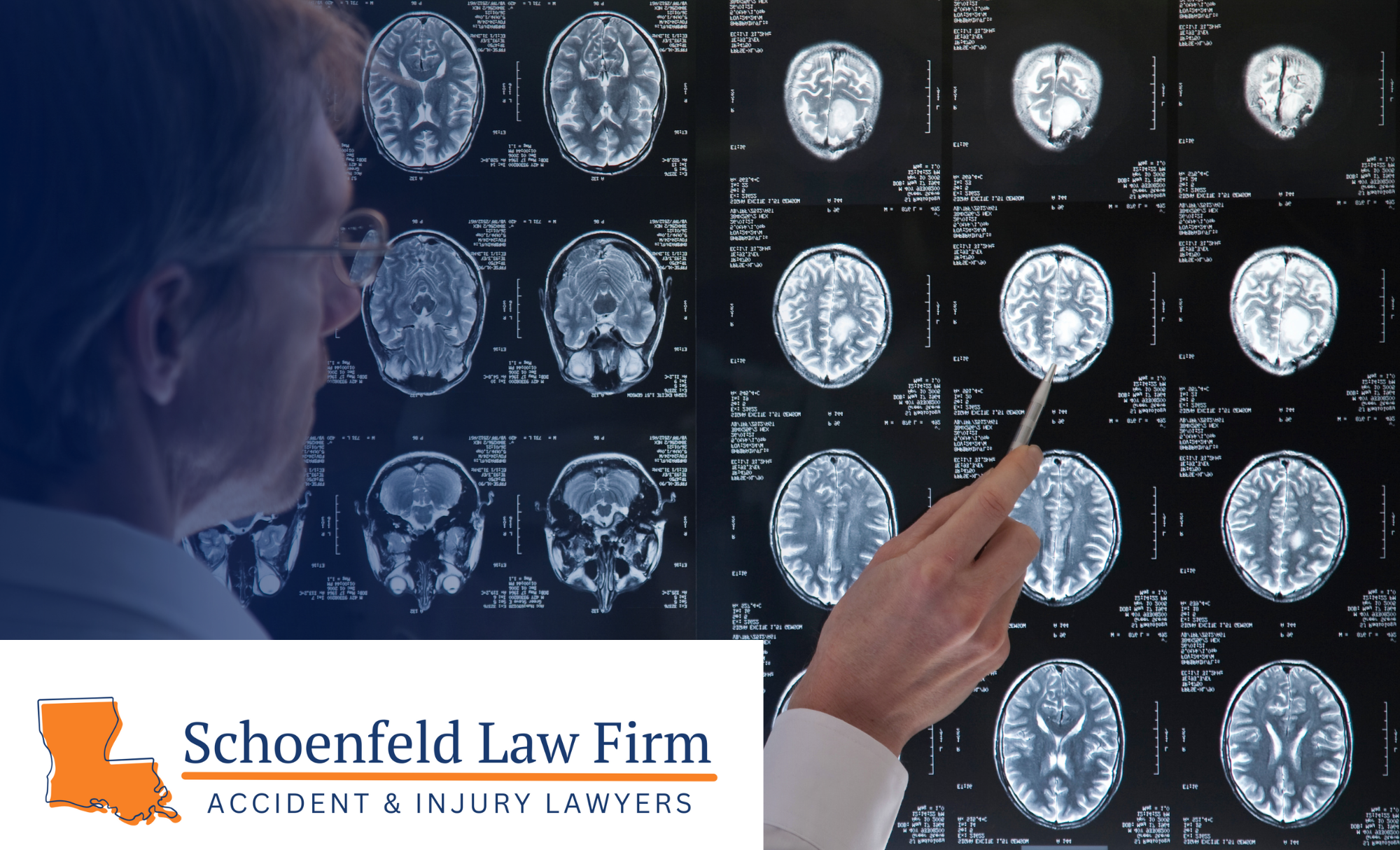 Schoenfeld-Law-Firm-TBI